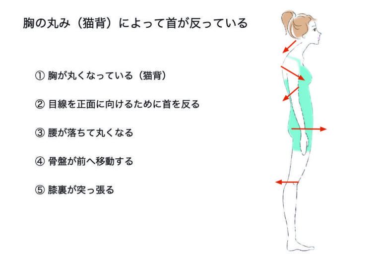 ご自分の猫背が気になる方へ 福岡今泉のマンツーマンレッスン ピラティススタジオ エアー